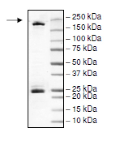 DNMT1 Coomassie gel