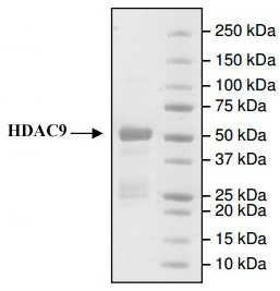 HDAC9 protein Coomassie gel