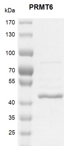 PRMT6 Coomassie gel