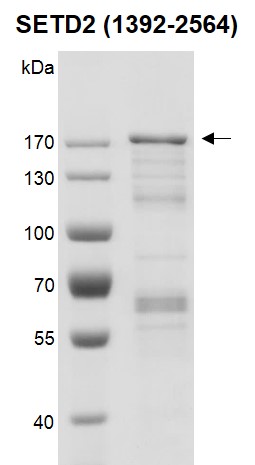 Recombinant SETD2 (1392-2564) protein gel.