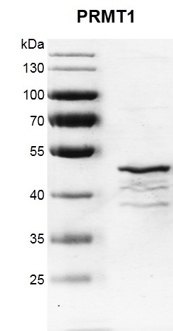 PRMT1 Coomassie gel