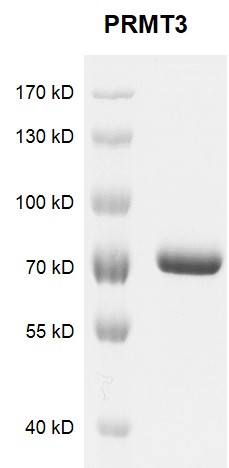 PRMT3 Coomassie gel