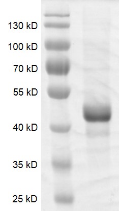 DNMT3L protein Coomassie gel