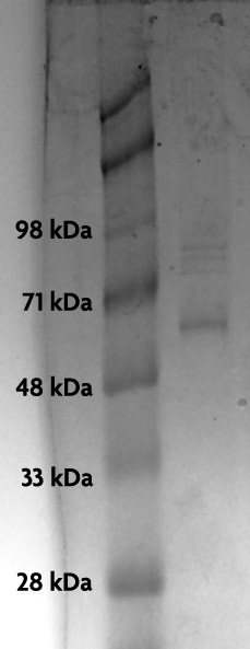 Recombinant p53 protein analyzed by SDS-PAGE gel.