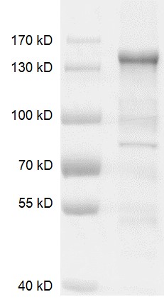 HDAC6 protein Coomassie gel