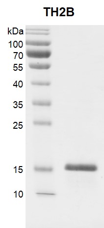 Recombinant Histone TH2B gel.