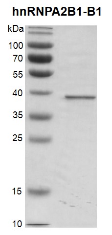 Recombinant hnRNPA2B1-B1 protein, SDS-PAGE gel.