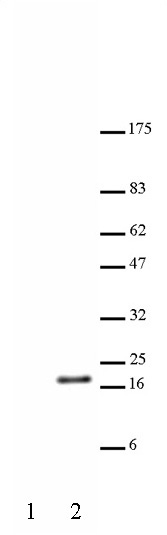Histone H3K23ac antibody (pAb) tested by Western blot.