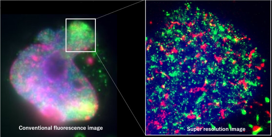 Histone H3 trimethyl Lys27  images using HM-1000 microcopy.