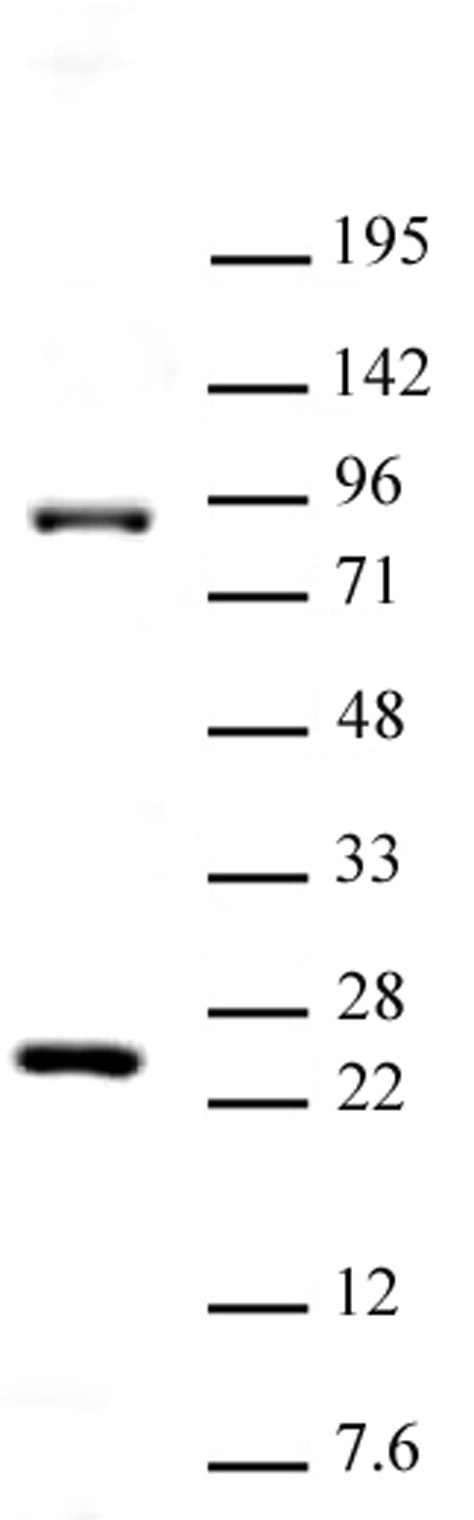 Suz12 antibody (pAb) tested by Western blot.