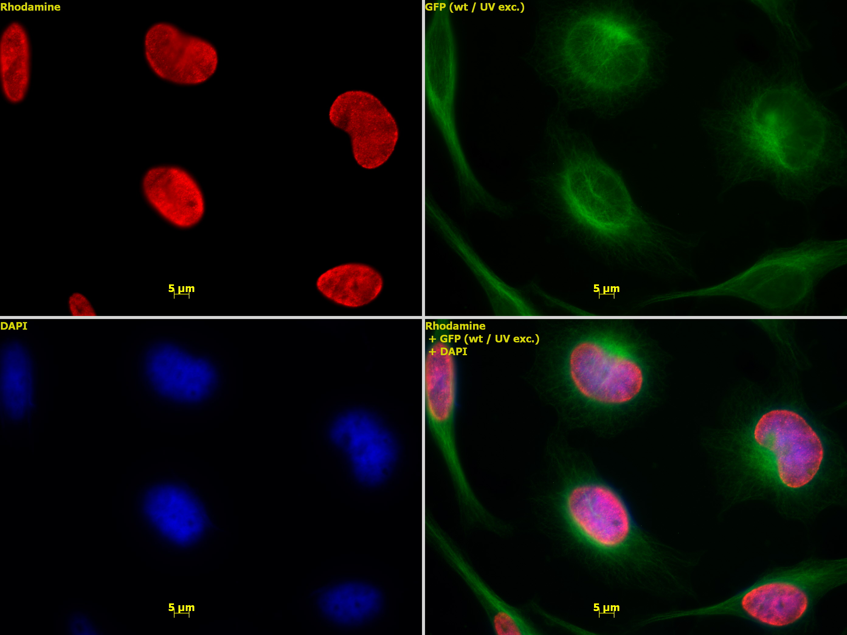 Histone H3K9me2 antibody (pAb) tested by immunofluorescence.
