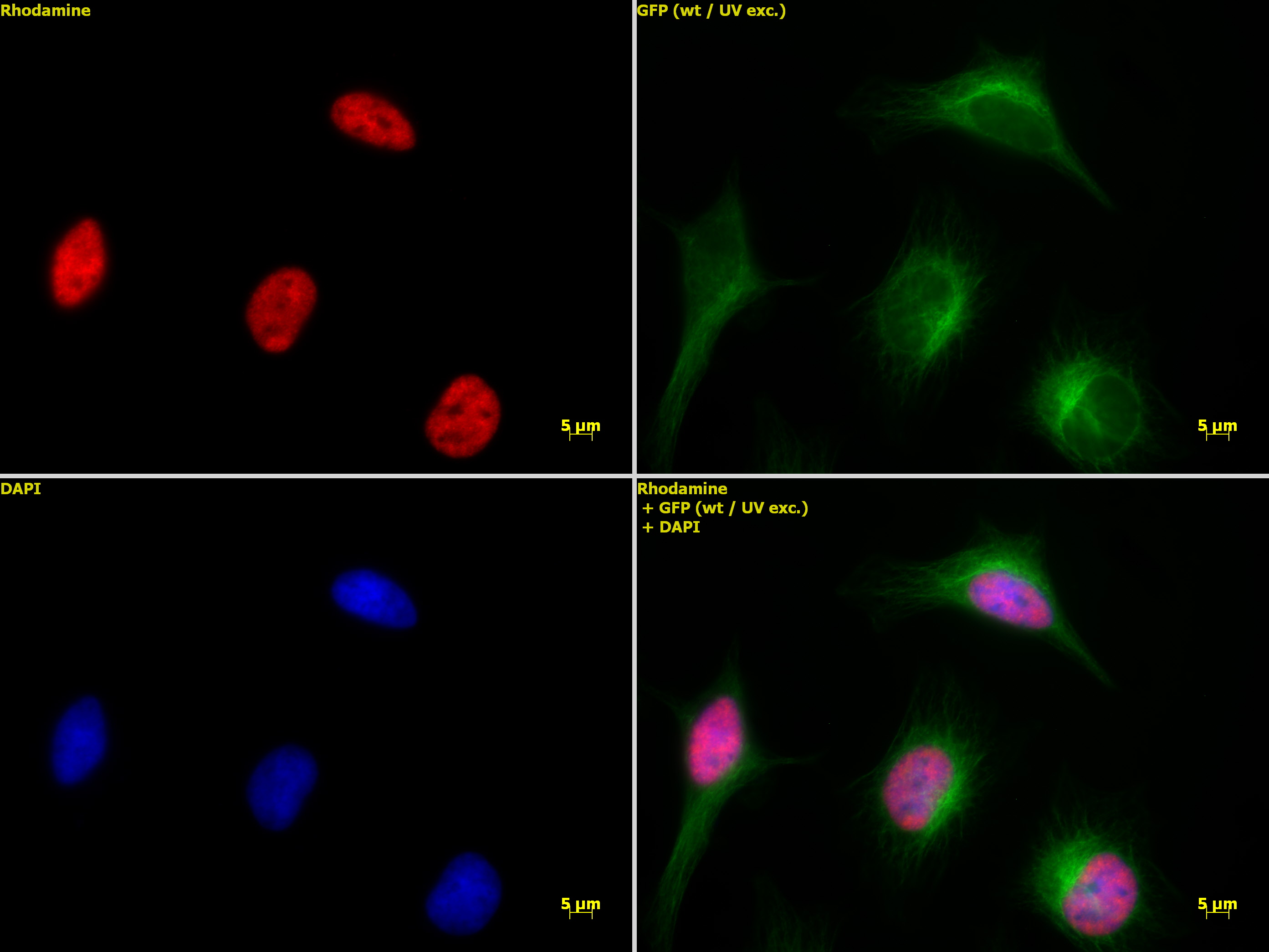 Histone H3K9ac antibody (pAb) tested by immunofluorescence.