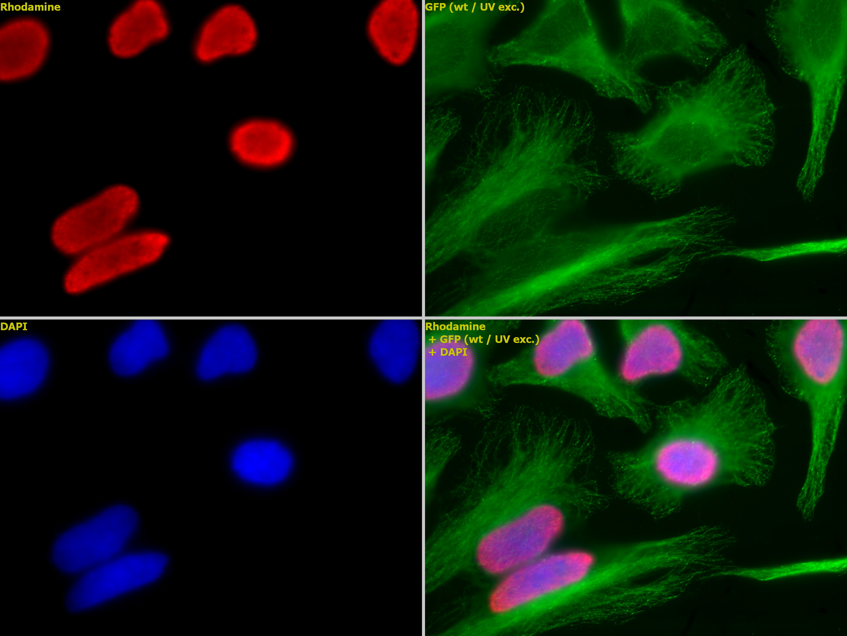 Histone H3K18ac antibody (pAb) tested by immunofluorescence.