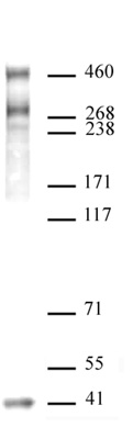 SMRT / NCoR2 antibody (pAb) tested by Western blot.