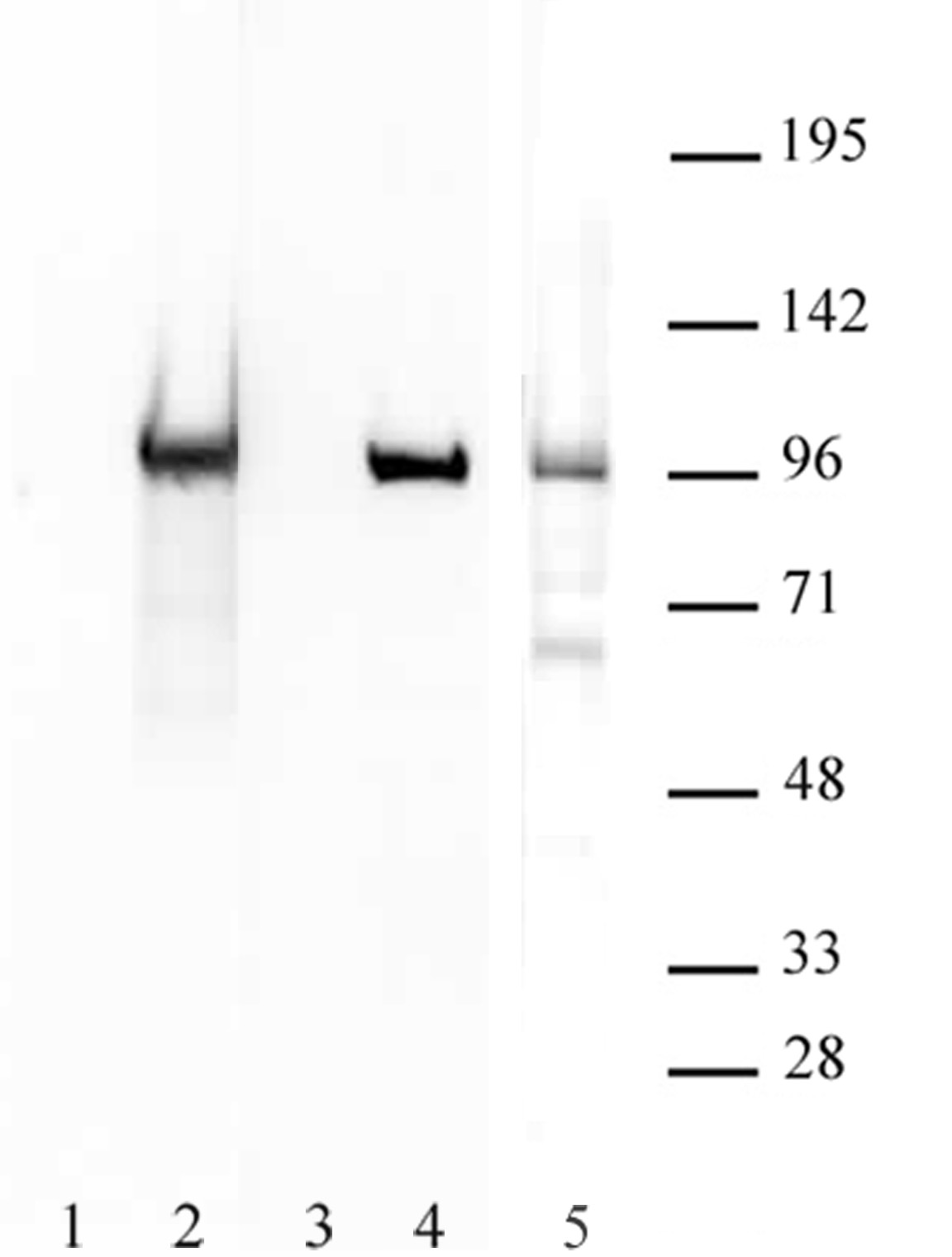 Boris / CTCFL antibody (pAb) tested by Western blot.