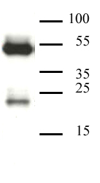 CAF-1 p60 antibody (mAb) tested by Western blot.
