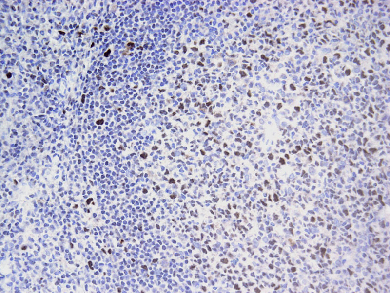 EED antibody (mAb) tested by immunohistochemistry.