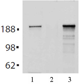 Tet2 antibody (mAb) tested by immunoprecipitation.