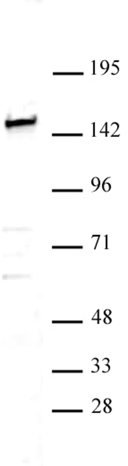 SMARCC1 / BAF155 antibody (pAb) tested by Western blot.
