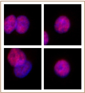 SMARCC2 / BAF170 antibody (pAb) tested by immunofluorescence.