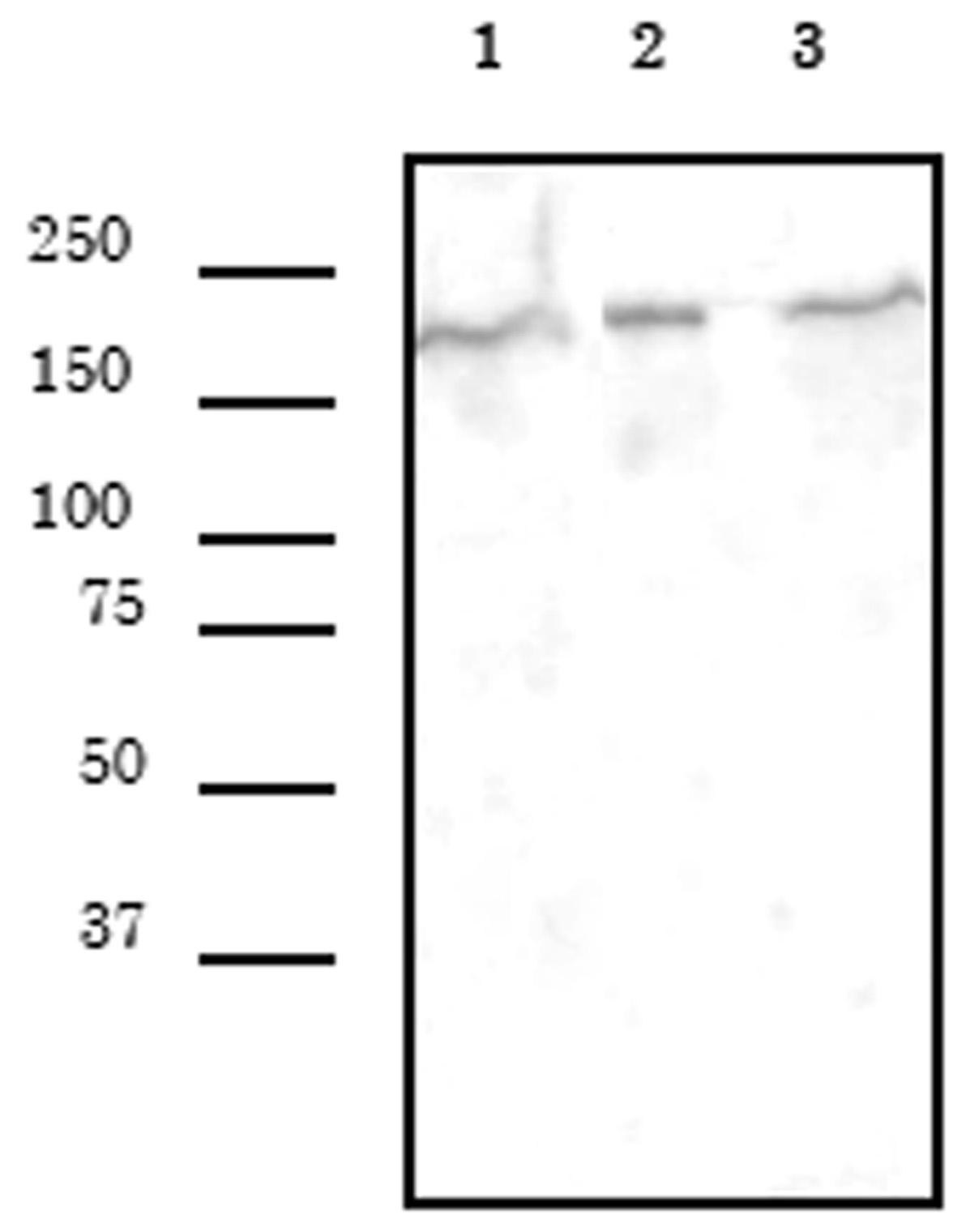 SMARCA4 antibody (mAb) tested by Western blot.