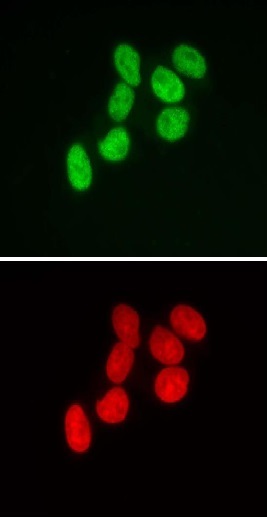 SMARCB1 antibody (mAb) tested by immunofluorescence.