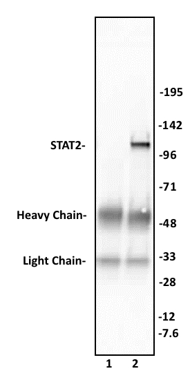STAT2 antibody (pAb) tested by immunoprecipitation.
