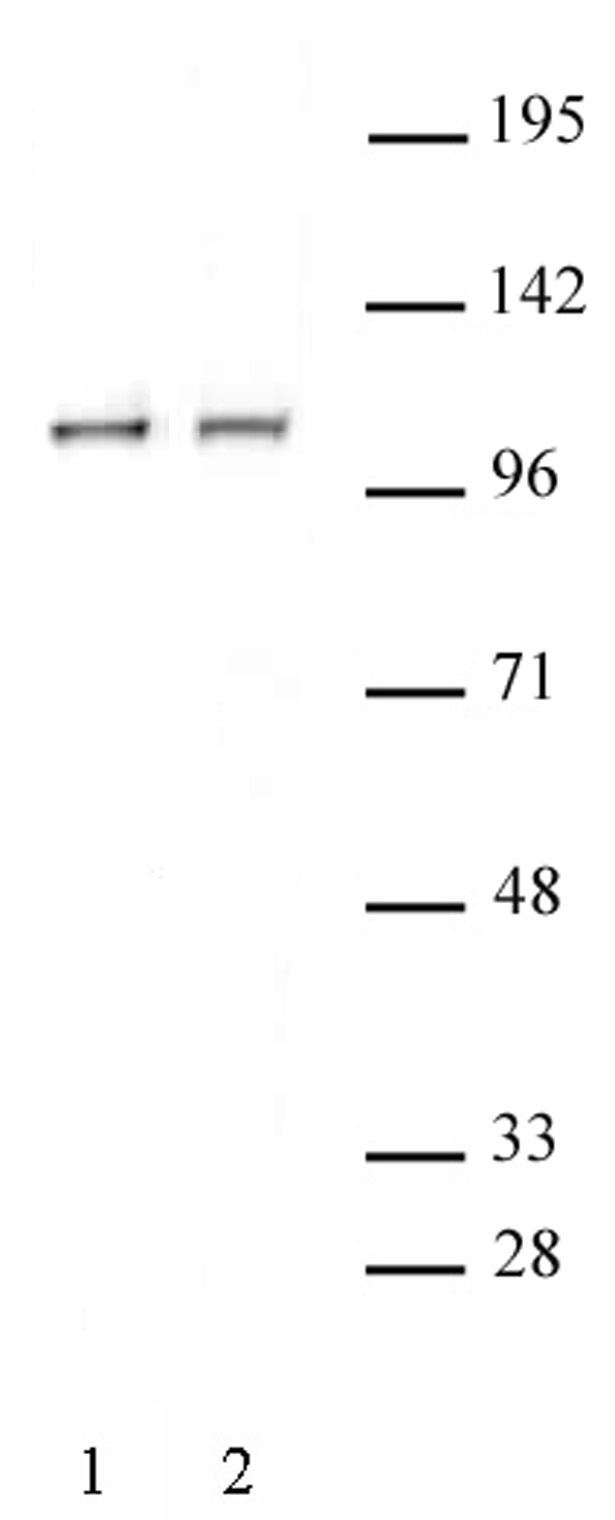 STAT2 antibody (pAb) tested by Western blot.