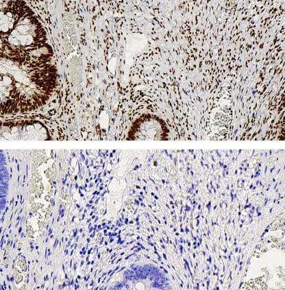 YY1 antibody (pAb) tested by immunohistochemistry.