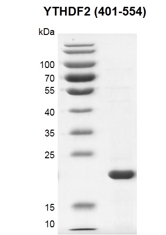 Recombinant YTHDF2 (401-554) SDS PAGE gel
