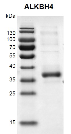 Recombinant ALKBH4 protein gel