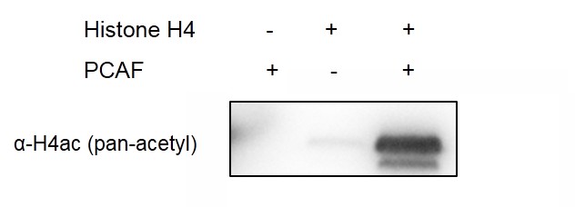 Western blot for recombinant PCAF activity