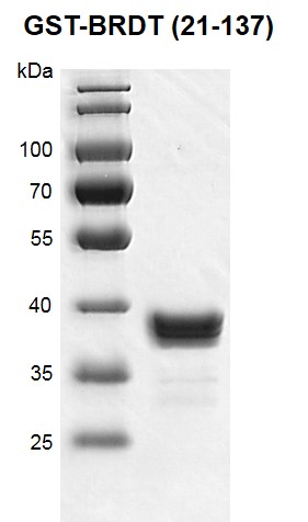 Recombinant BRDT (21-137) protein, GST-Tag protein gel