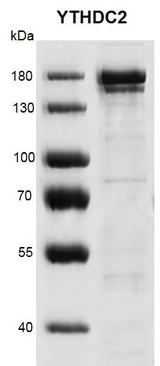 Recombinant YTHDC2 protein gel