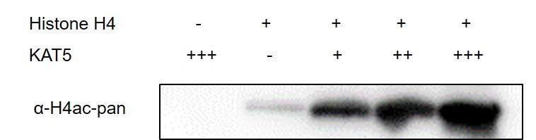 Western blot for Recombinant KAT5 protein activity