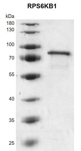 Recombinant RPS6KB1 protein