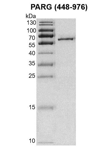 Recombinant PARG (448-976) protein Coomassie gel