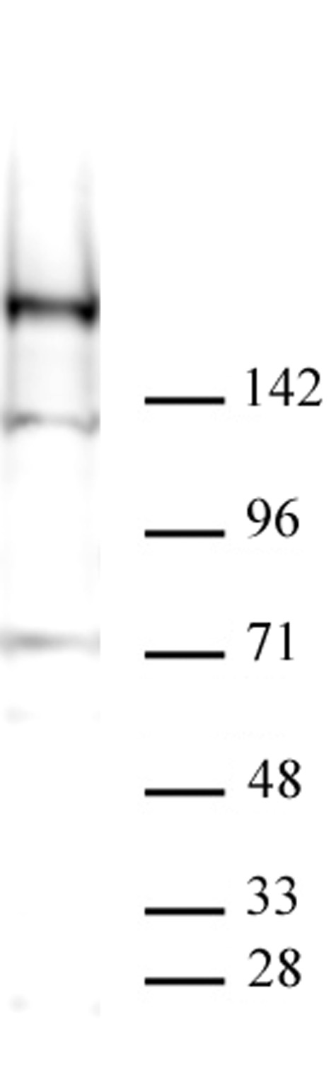 Specificity of AbFlex® KDM5A demonstrated by Western blot.