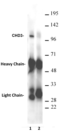 AbFlex<sup>&reg;</sup> CHD3 antibody (rAb) tested by immunoprecipitation.