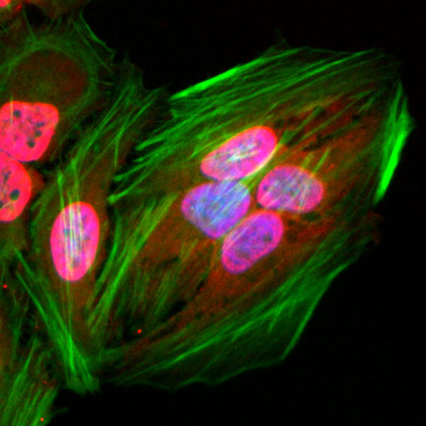 Acetyl-Lysine antibody (rAb) tested by immunofluorescence.