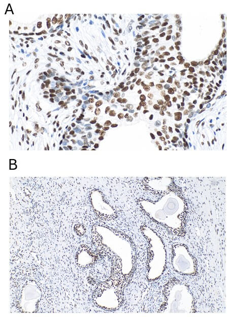 CREB1 phospho Ser133 (rAb), 100 µg tested by immunohistochemistry.