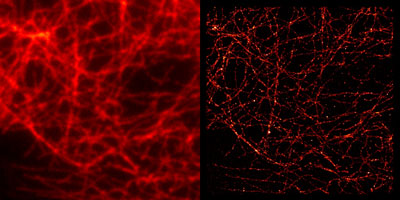 Comparison of conventional widefield microscopy and GSDIM microscopy using Rhodamine 6G (GSD) Goat anti-mouse IgG secondary antibody