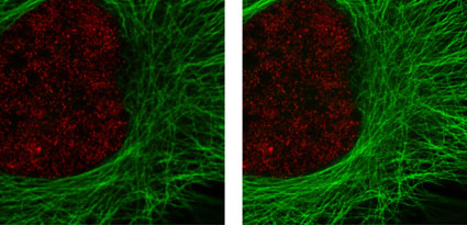 HeLa cells stained by alpha-Tubulin mAb with ATTO 647N (STED/GSD) Fluorescent Secondary Antibody and Histone H3 trimethyl Lys4 with Chromeo 488 Fluorescent Secondary Antibody using both confocal and STED microscopy