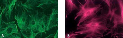 Chariot delivery of fluorescent Actin antibody into fixed and unfixed human fibroblast (HS-68) cells