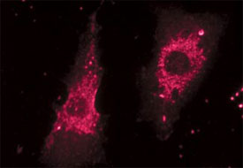 Chariot delivery of fluorescent Lamp-1 antibody