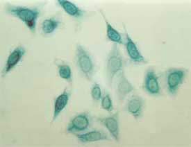 Chariot delivery of beta-galactosidase into HeLa cells
