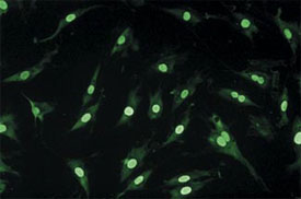 Targeted Chariot delivery of nuclear protein directly into the nucleus