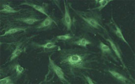 Chariot delivery of peptide into the cytoplasm of mouse 3T3 cells