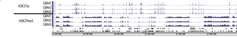 H3K27ac and H3K27me3 ChIP-Seq on Glioblastoma Samples.