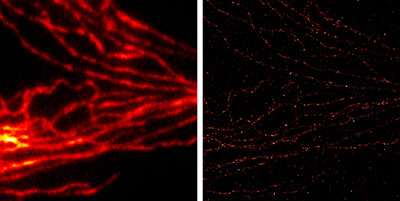 Comparison of conventional widefield microscopy and GSDIM microscopy using ATTO 532 (GSD) Goat anti-mouse IgG secondary antibody